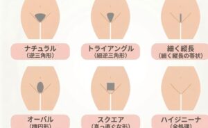 『アンダーヘアの形』について