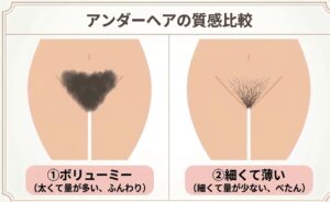 アンダーヘア毛量